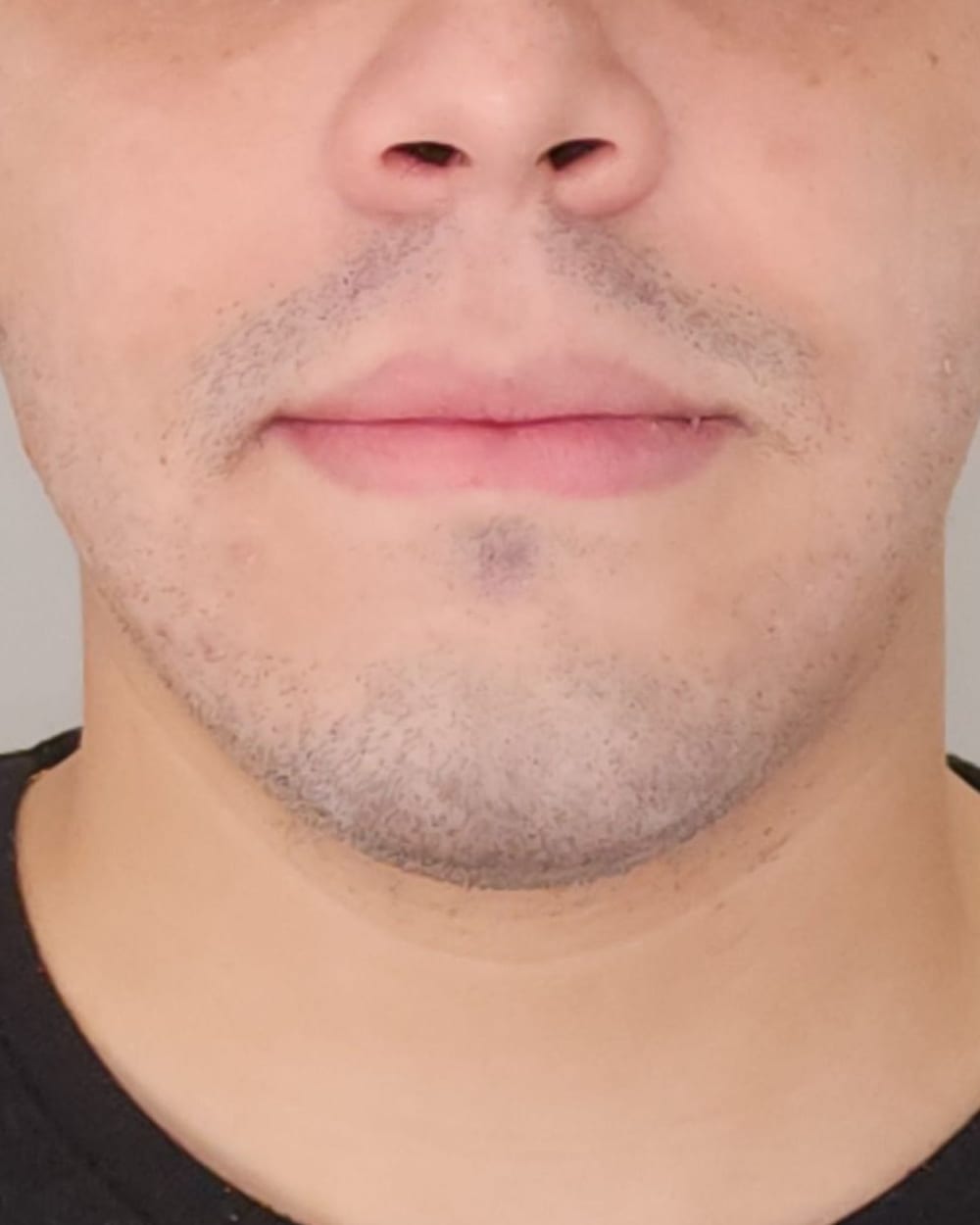 O mesmo enquadramento em maio de 2025, em repouso, sem a barba